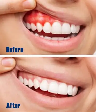 dental-clinics-in-erode